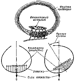 Схема отолитового аппарата